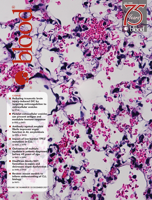 BACH2 is a putative T cell lymphoma tumor suppressor.