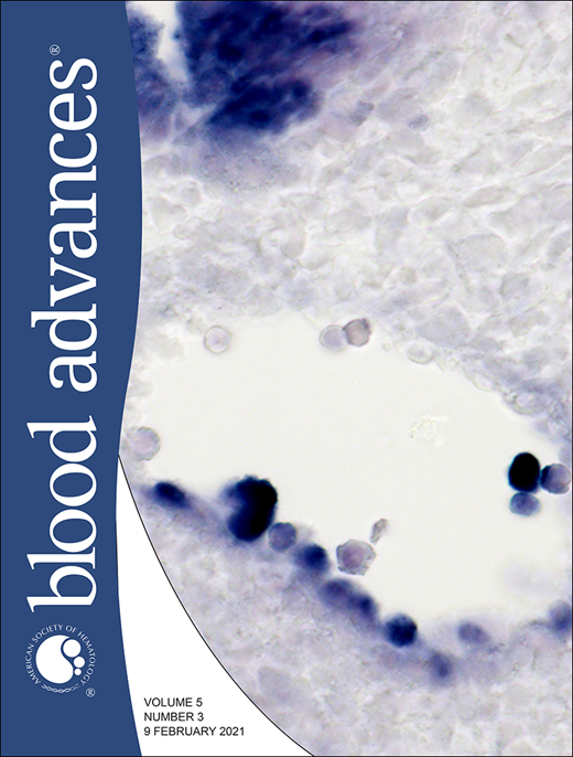 Genomic landscape of cutaneous T cell lymphoma and related diseases.
