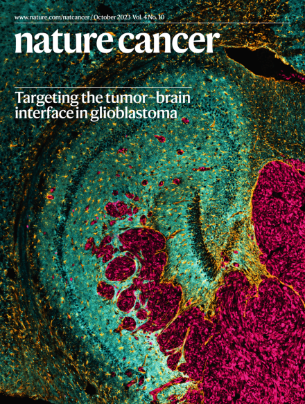 PD-1 instructs a tumor-suppressive metabolic program in T cell lymphoma.