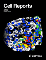 ZEB1 promotes pathogenic programs in cutaneous T cell lymphoma.